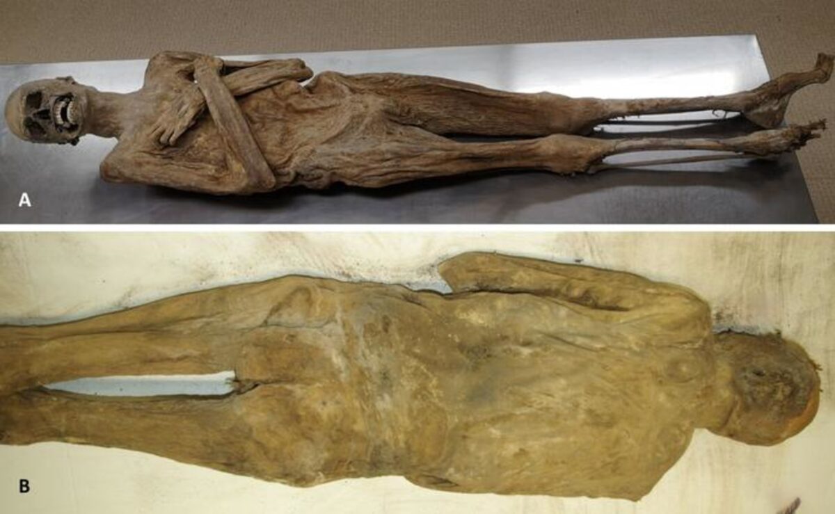 Mummy front and back
