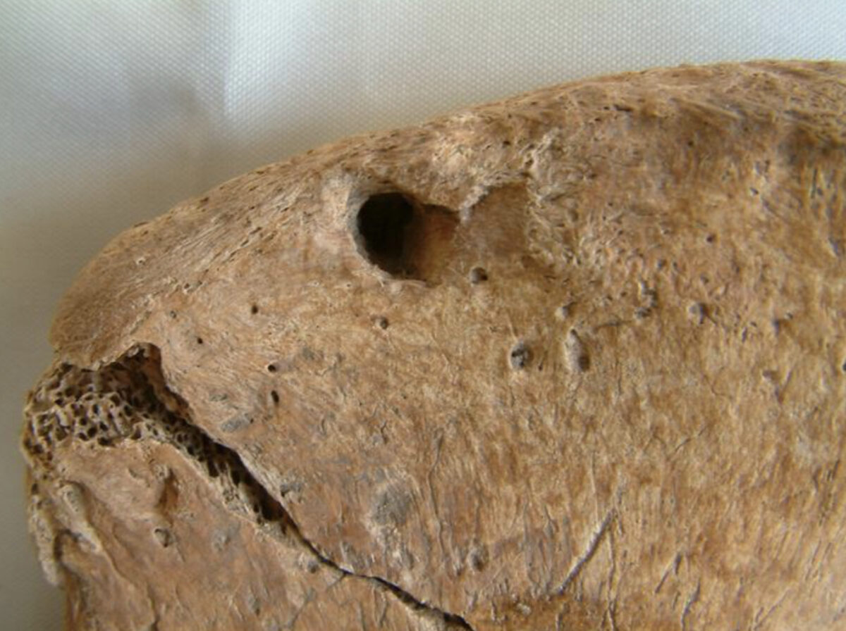 Lion tooth mark on the hip bone